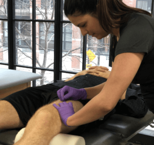Dry Needling 300x283 Functional Dry Needling