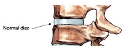 3 of The Leading Causes of Lower Back Pain & Sciatica Back Image 1 3 of The Leading Causes of Lower Back Pain & Sciatica