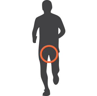 Pelvic Floor